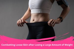 Loose Skin after Losing a Large Amount of Weight