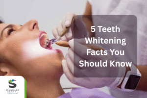 5 Teeth Whitening Facts You Should Know