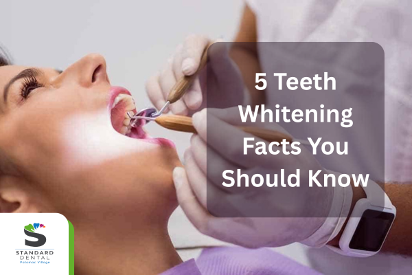 5 Teeth Whitening Facts You Should Know
