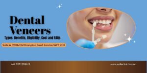 porcelain veneers cost in London