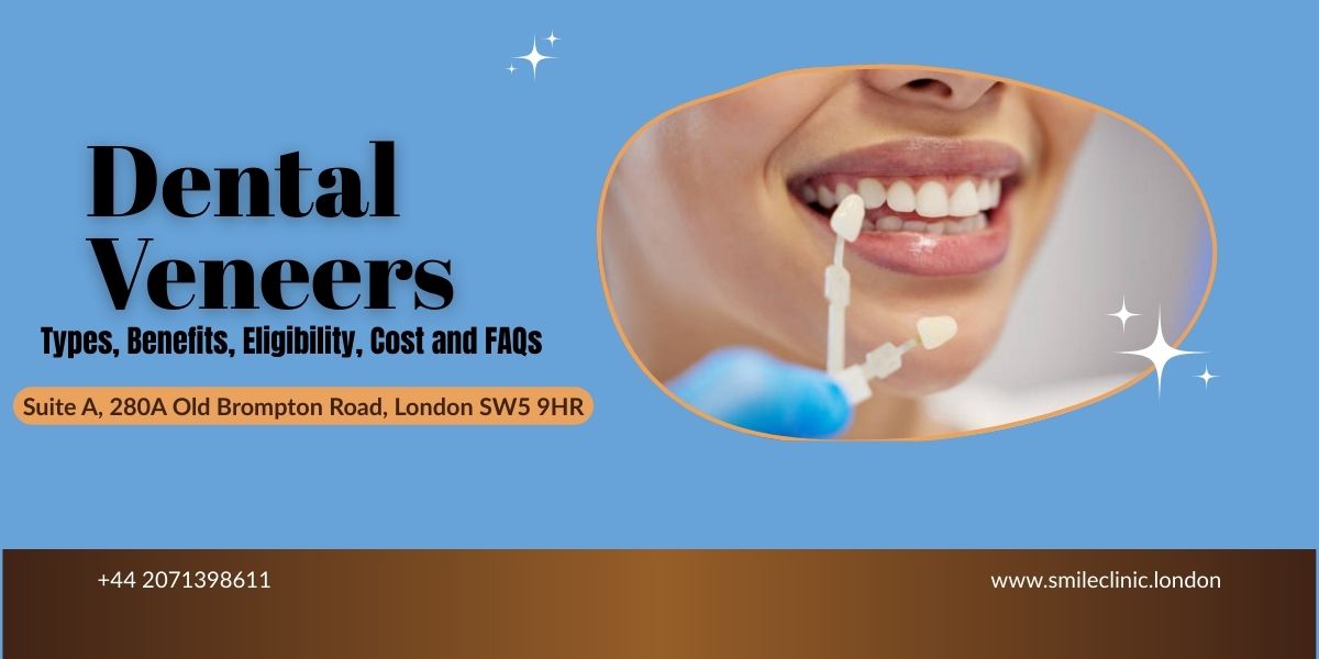 porcelain veneers cost in London