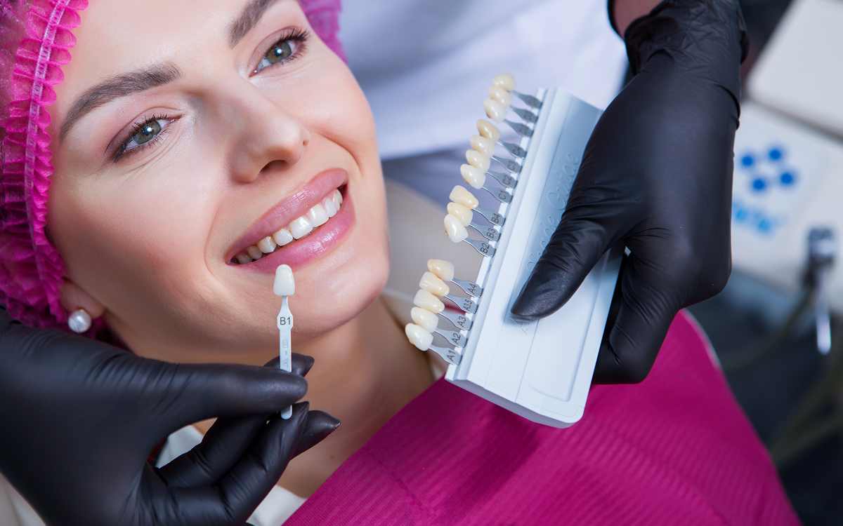 Dental Veneers