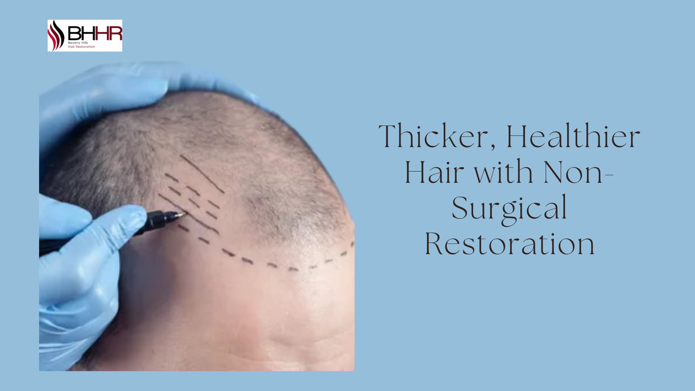 non surgical hair restoration