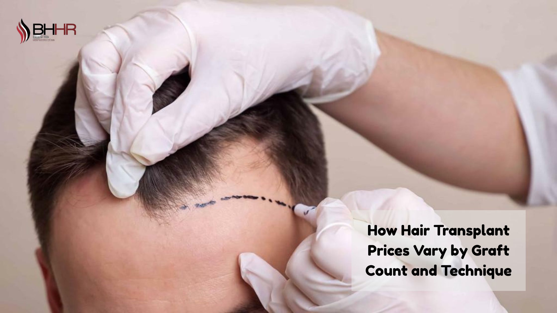hair transplant price