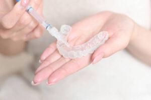 Teeth Whitening in Riyadh