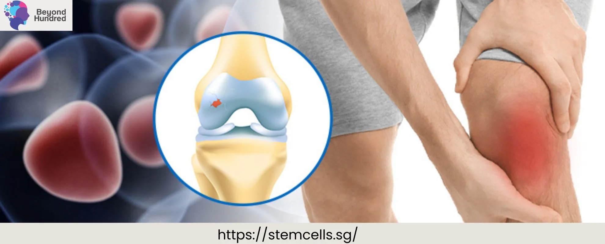 Stem Cell Therapy Singapore | Patient Journey, Injections & Costs