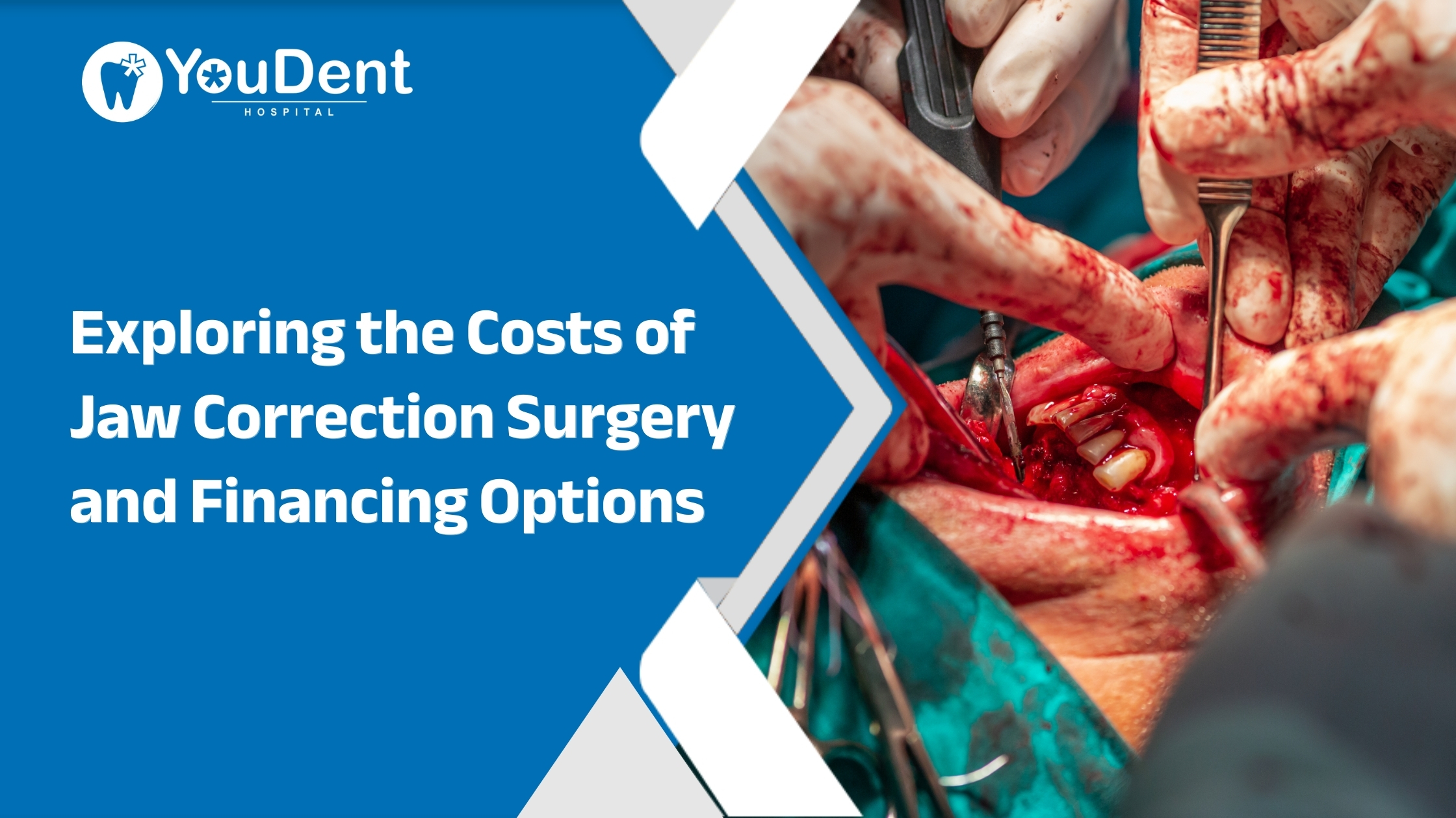 jaw correction surgery in India