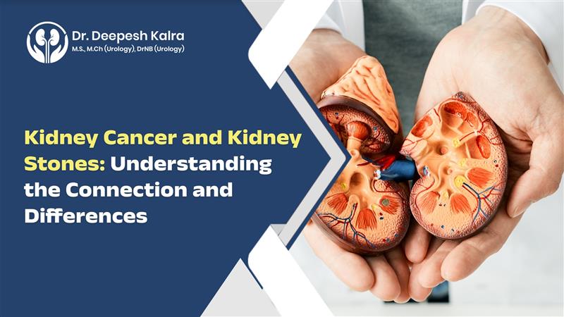 Best Kidney stone doctor in Jaipur