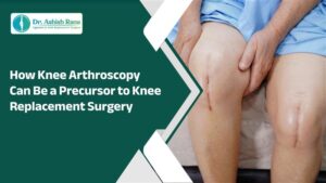 Best Knee Replacement Surgeon In Jaipur