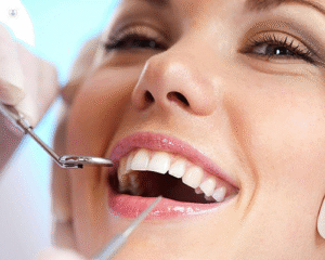 Root Canal Removal Tampa