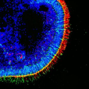 Retinal Organoids