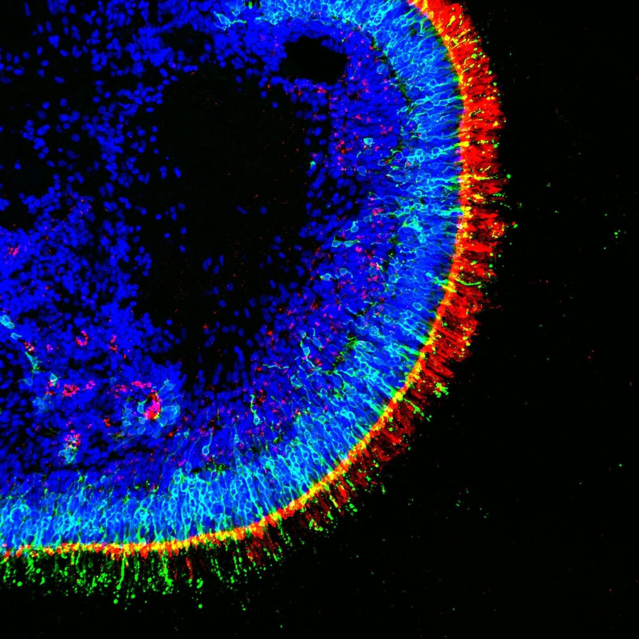 Retinal Organoids