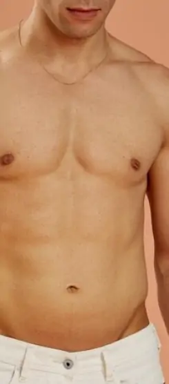 شفط الدهون في جدة للحصول على قوام متناسق